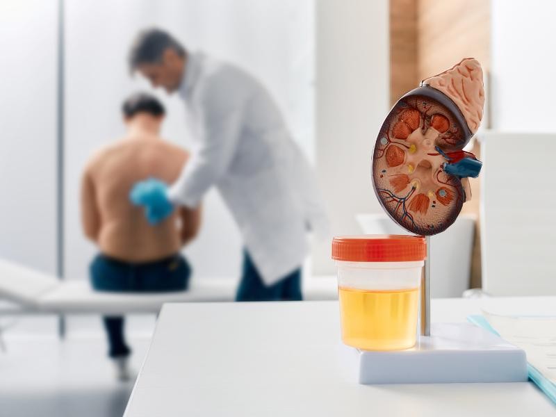 Exames Preventivos em Urologia: Por Que Todo Homem Deve Priorizar Sua Saúde