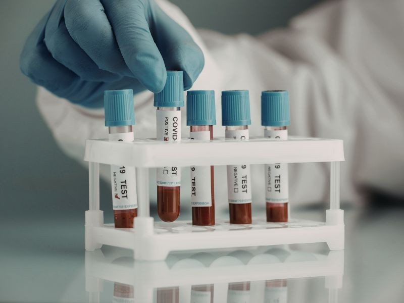 O que seu Exame de Sangue diz sobre você? A Importância do Check-up Anual