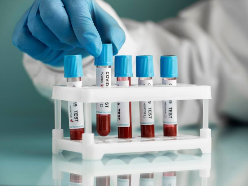 Seu Corpo Fala: 5 Marcadores no Exame de Sangue que Você Precisa Entender