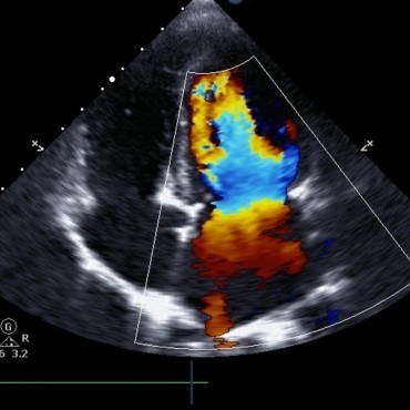 Ultrassonografia com Doppler em Vigia