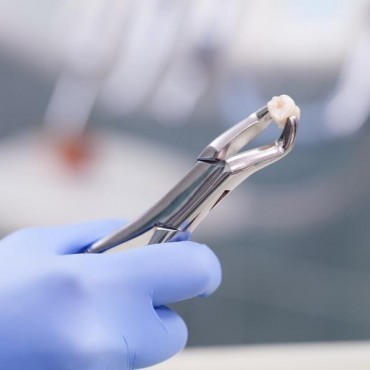 Extração Dentária em Vigia