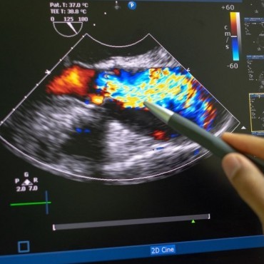 Ultrassom Morfológica do 2º Trimestre em Benevides