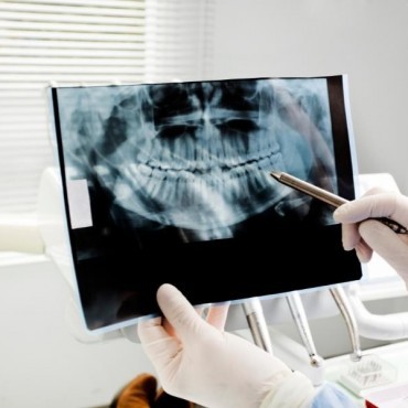 Raio-X Periapical em Vigia