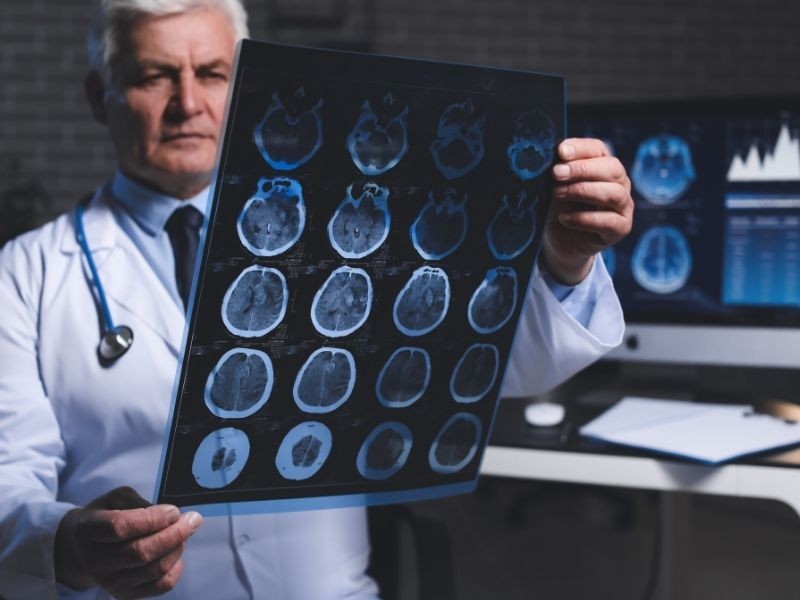 Consulta Neurologista