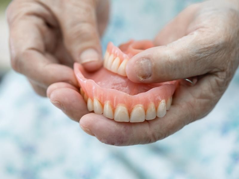 Prótese Total Dentária (Dentadura)