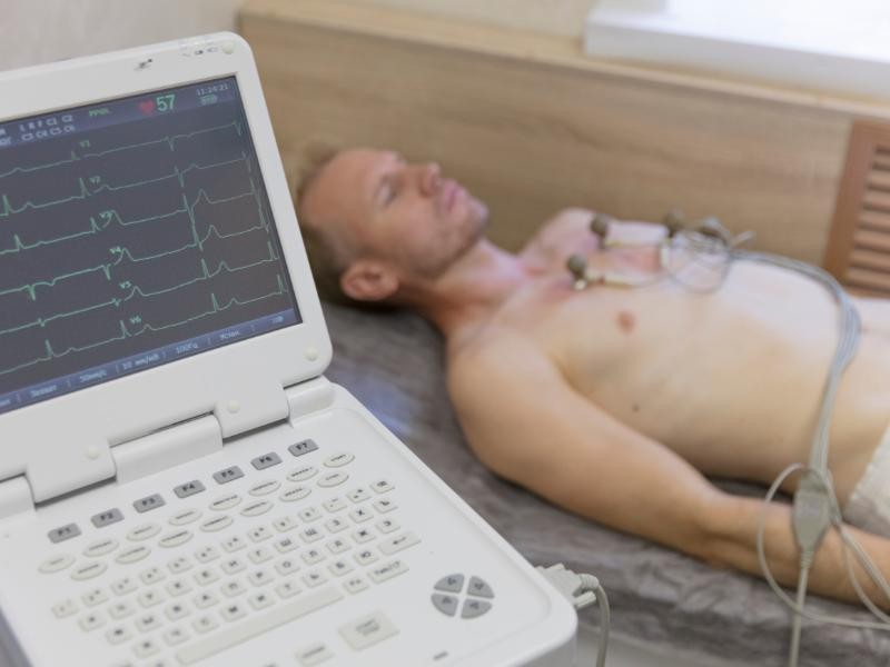 Eletrocardiograma (ECG)