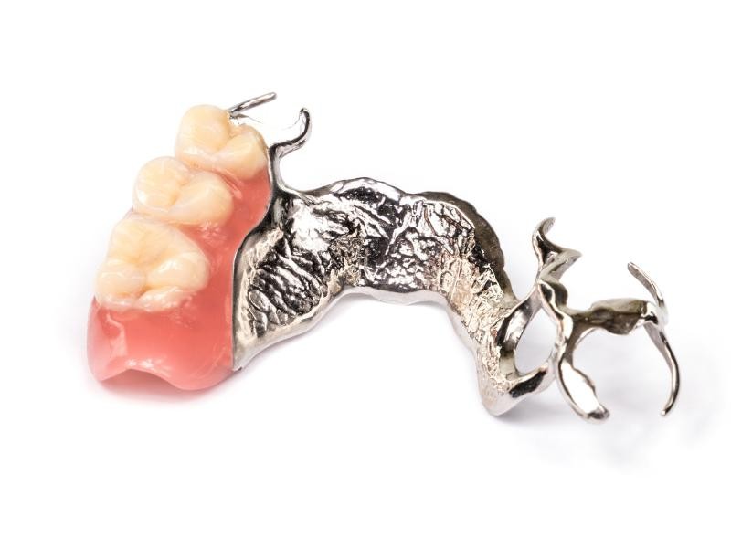 Prótese Parcial Dentária