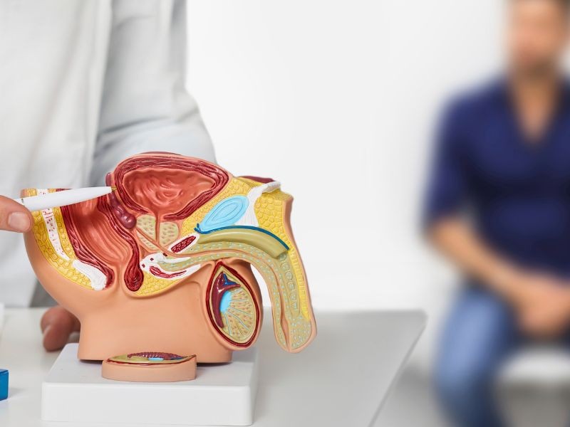 Ultrassom de Próstata Via Abdominal